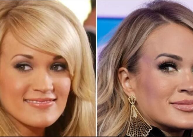 Everything Carrie Underwood Has Said About Plastic Surgery: Photos of the Singer Then and Now